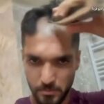Ιρανός ποδοσφαιριστής ξύρισε το κεφάλι του για ιδιαίτερο λόγο (vid)