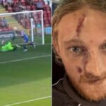 Σοκαριστικός τραυματισμός στο πρόσωπο για παίκτη της Καρλάιλ