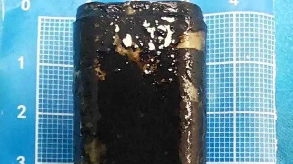 Απίστευτο: Κατάπιε αναπτήρα για challenge και 30 χρόνια μετά λειτουργούσε